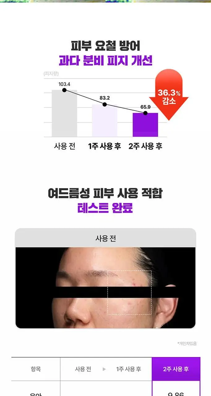 [단독기획/대용량] 파티온 노스카나인 트러블 모공탄력 세럼 50ml 기획(+5ml+크림 5ml) 상세페이지 20